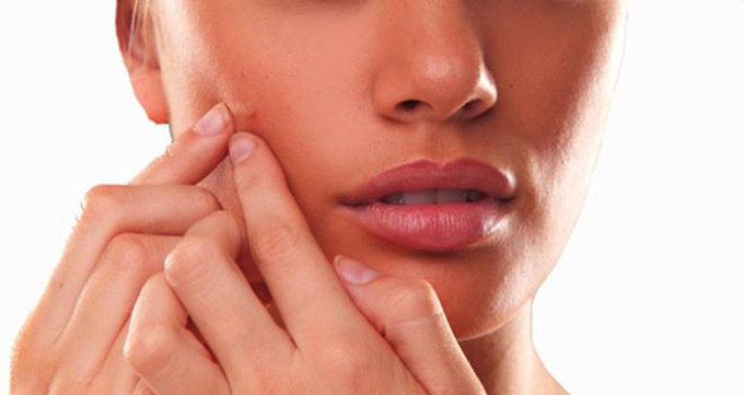 cystic-acne-causes-and-treatments