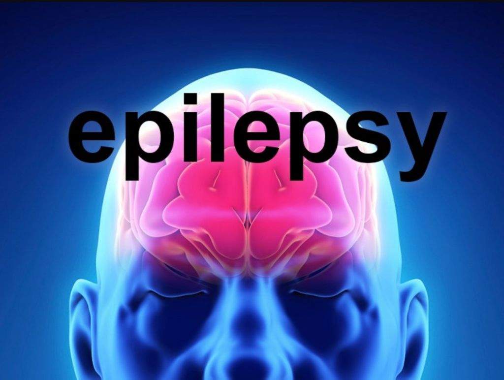 keto-diet-epilepsy