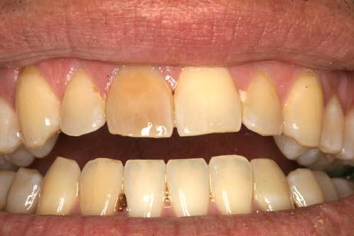 Cosmetic Dentistry to Improve Your Smile 