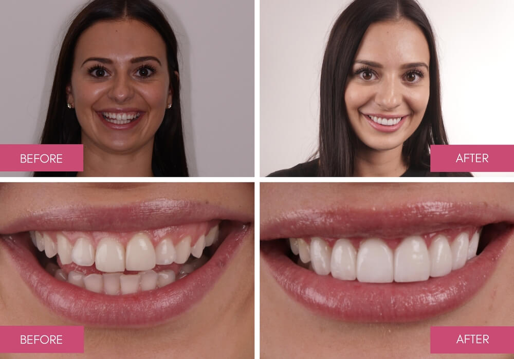 Cosmetic Dentistry to Improve Your Smile